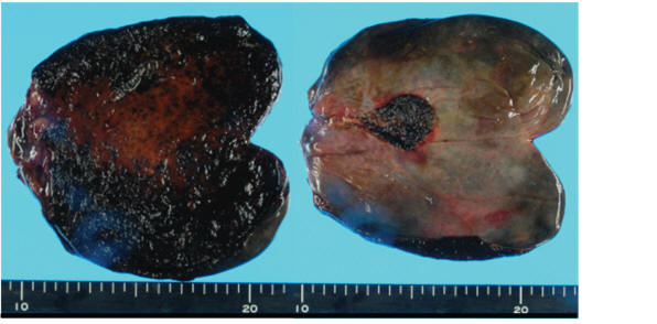 Diagram Of A Bladder