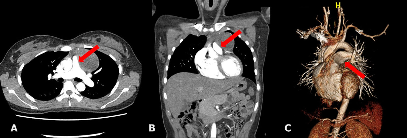 Figure 3. 