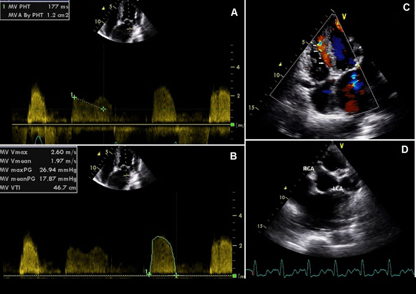 Figure 3. 