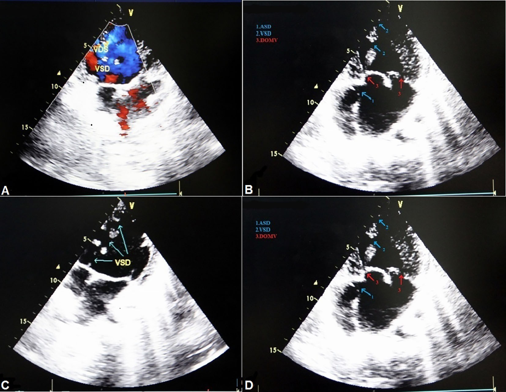 Figure 2. 