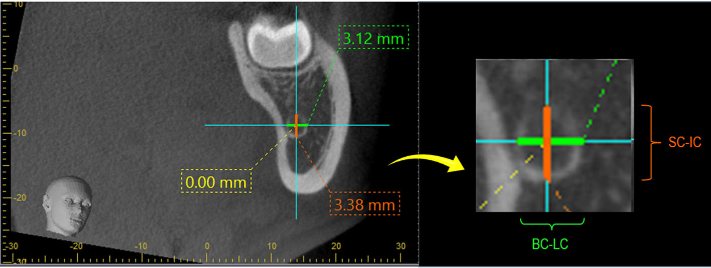 Figure 3. 