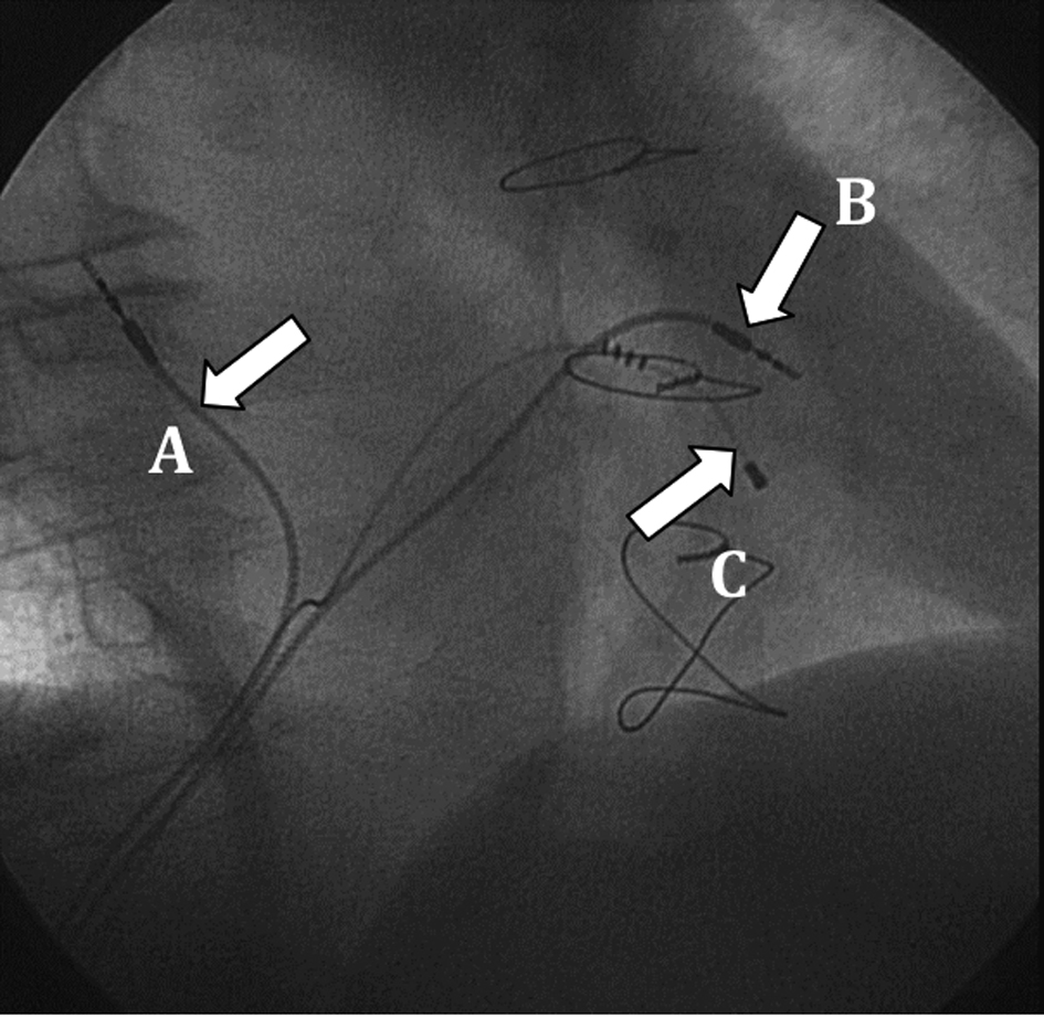 Figure 3. 